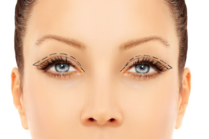 types of eyelid surgeries
