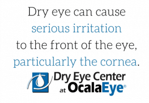 ocala-eye-dry-eye