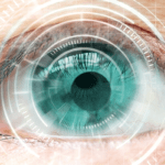 Eye - LASIK
