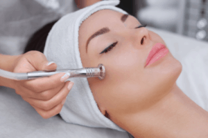effects of microdermabrasion