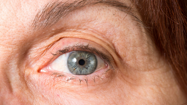 cataract surgery