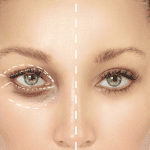 Eyelids